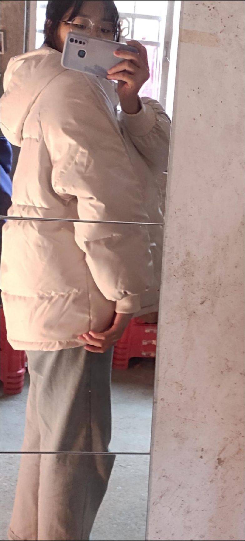 图片咋没了啊
